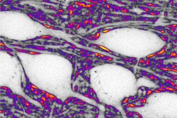 The space between neurons: a territory to explore to understand brain aging and diseases such as Parkinson’s